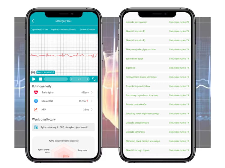 EKG - 2.jpg